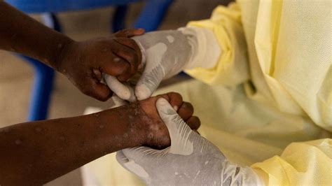 pinoy straight twitter iloilo|Mpox threat spurs Iloilo to mobilize quarantine measures as .